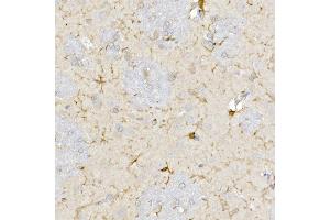Immunohistochemistry (IHC) image for anti-Mitochondrial Import Receptor Subunit TOM20 homolog (TOMM20) (AA 20-145) antibody (ABIN7268554)