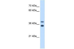 GDE1 antibody used at 0.