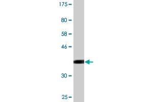 Western Blot detection against Immunogen (37. (Cyclin T2 antibody  (AA 264-370))