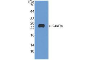 Western blot analysis of recombinant Human SCFR. (KIT antibody  (AA 321-520))