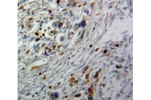 IHC-P analysis of Pancreas tissue, with DAB staining. (CDK9 antibody  (AA 104-315))