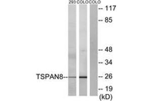 Western blot analysis of extracts from 293/COLO cells, using TSPAN8 Antibody. (Tspan-8 antibody  (AA 96-145))