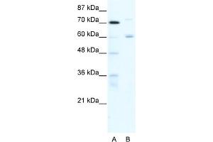 WB Suggested Anti-FOXJ2 Antibody Titration:  0.