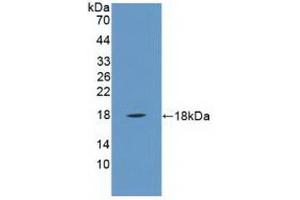 Detection of Recombinant PLA2G2A, Human using Polyclonal Antibody to Phospholipase A2, Group IIA (PLA2G2A) (PLA2G2A antibody  (AA 21-144))