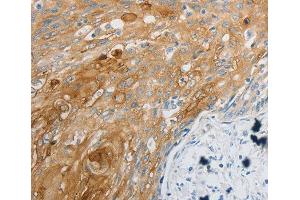 Immunohistochemistry (IHC) image for anti-Endothelin Receptor Type B (EDNRB) (AA 1-100) antibody (ABIN6219903) (EDNRB antibody  (AA 1-100))