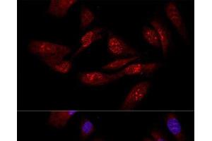 Immunofluorescence (IF) image for anti-Eukaryotic Translation Initiation Factor 6 (EIF6) antibody (ABIN7259799)
