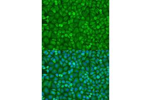 Immunofluorescence (IF) image for anti-Eukaryotic Translation Initiation Factor 4E (EIF4E) (AA 1-100) antibody (ABIN3023085)