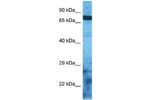Host:  Rabbit  Target Name:  ZSC12  Sample Type:  RPMI-8226 Whole Cell lysates  Antibody Dilution:  1. (ZSC12 antibody  (N-Term))