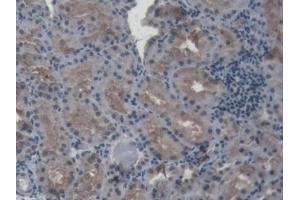 Detection of HIF1a in Porcine Kidney Tissue using Polyclonal Antibody to Hypoxia Inducible Factor 1 Alpha (HIF1a) (HIF1A antibody  (AA 585-824))