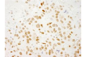 Immunohistochemistry (IHC) image for anti-Protein Quaking (QKI) (C-Term), (Isoform 5) antibody (ABIN7448749)