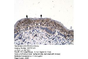 Human Spermatophore (JMJD8 antibody  (Middle Region))