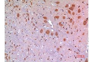 Immunohistochemistry (IHC) analysis of paraffin-embedded Rat Brain, antibody was diluted at 1:100. (MANF antibody  (Internal Region))