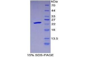 SDS-PAGE analysis of Human Protease, Serine 1 Protein. (Protease (Ser1) Protein)