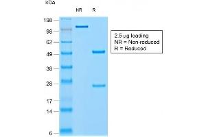 SDS-PAGE Analysis of Purified CHGA Mouse Recombinant Monoclonal Antibody ABIN6383803. (Recombinant Chromogranin A antibody)