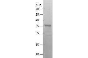 SKIL Protein (AA 404-684) (His tag)