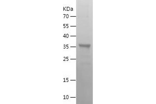 SKIL Protein (AA 404-684) (His tag)