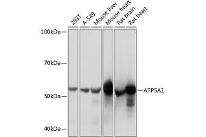Western blot analysis of extracts of various cell lines, using  Rabbit mAb (1217) at 1:1000 dilution. (ATP5A1 antibody)