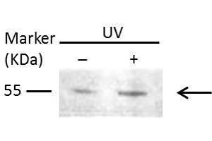 WB Image Sample (30 ug of whole cell lysate) A: Raji 10% SDS PAGE antibody diluted at 1:1000 (MMP1 antibody)