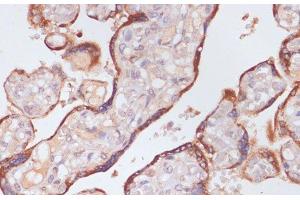 Immunohistochemistry of paraffin-embedded Human placenta using KLKB1 Polyclonal Antibody at dilution of 1:100 (40x lens). (KLKB1 antibody)