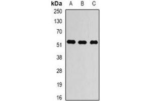 Western blot analysis of Alpha-tubulin 4a expression in LOVO (A), HEK293T (B), HUVEC (C) whole cell lysates. (TUBA4A antibody)