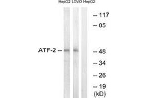 Western blot analysis of extracts from HepG2/LOVO cells, using ATF2 (Ab-69 or 51) Antibody. (ATF2 antibody  (AA 35-84))