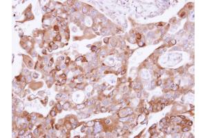 IHC-P Image Immunohistochemical analysis of paraffin-embedded H441 xenograft, using UFD1L, antibody at 1:500 dilution.