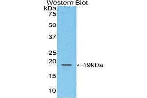 Western blot analysis of the recombinant protein. (CD97 antibody  (AA 32-173))