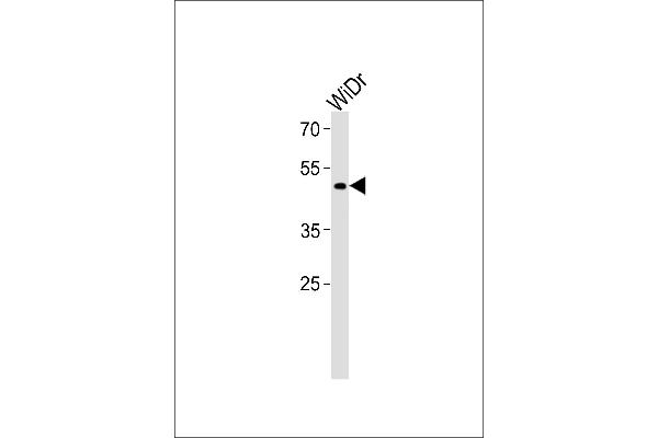 TFDP3 antibody  (N-Term)