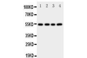 Western Blotting (WB) image for anti-Cystatin A (Stefin A) (CSTA) (AA 77-90), (C-Term) antibody (ABIN3042657) (CSTA antibody  (C-Term))