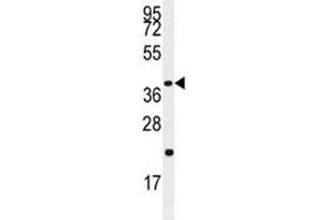 Western Blotting (WB) image for anti-Caspase 9, Apoptosis-Related Cysteine Peptidase (CASP9) (Ser196) antibody (ABIN3030322)