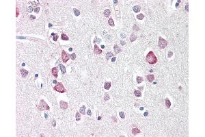 Anti-NEUROG2 / NGN2 / Neurogenin 2 antibody IHC staining of human brain, cortex. (Neurogenin 2 antibody  (C-Term))