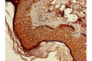 Immunohistochemistry of paraffin-embedded human skin tissue using ABIN7142284 at dilution of 1:100 (HSD3B1 antibody  (AA 127-267))