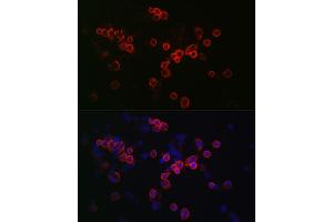 Immunofluorescence analysis of R. (CCR7 antibody  (AA 1-100))