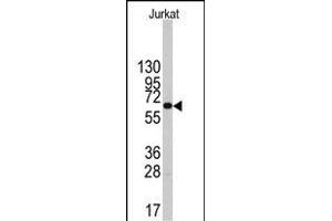 Western blot analysis of anti-PFKFB1 Antibody (Center) (ABIN392772 and ABIN2842216) in Jurkat cell line lysates (35 μg/lane).
