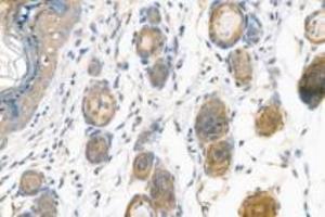Immunohistochemistry (Paraffin-embedded Sections) (IHC (p)) image for anti-alpha-Actinin Skeletal Muscle (ACTN) antibody (ABIN7073023)