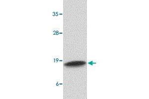 Western blot analysis of CAMP in human spleen tissue lysate with CAMP polyclonal antibody  at 1 ug/mL .