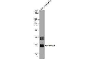 WB Image MMP10 antibody detects MMP10 protein by western blot analysis. (MMP10 antibody)