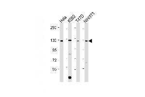 All lanes : Anti-ROR2 Antibody (C-term) at 1:2000 dilution Lane 1: Hela whole cell lysate Lane 2: K562 whole cell lysate Lane 3: T47D whole cell lysate Lane 4: NIH/3T3 whole cell lysate Lysates/proteins at 20 μg per lane. (ROR2 antibody  (C-Term))