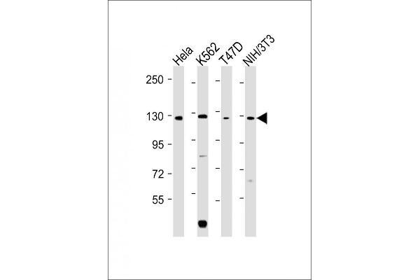 ROR2 antibody  (C-Term)