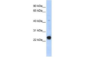 WB Suggested Anti-C16orf80 Antibody Titration:  0. (C16orf80 antibody  (Middle Region))