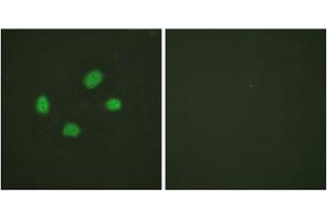 Immunofluorescence analysis of HeLa cells, using Chk2 (Phospho-Thr383) antibody. (CHEK2 antibody  (pThr383))