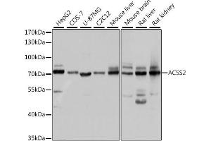 Western blot analysis of extracts of various cell lines, using  antibody (ABIN6131387, ABIN6136467, ABIN6136469 and ABIN6222130) at 1:1000 dilution. (ACSS2 antibody)