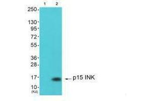 Western blot analysis of extracts from 293 cells (Lane 2), using p15 INK antiobdy.