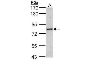 WB Image Sample (30 ug of whole cell lysate) A: Molt-4 , 7. (MTMR14 antibody)