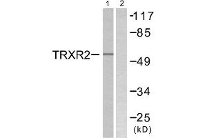 Western blot analysis of extracts from HT29 cells, using TRXR2 antibody. (TXNRD2 antibody  (C-Term))