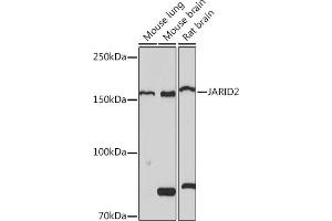 Western blot analysis of extracts of various cell lines, using J Rabbit mAb (ABIN7268047) at 1:1000 dilution.