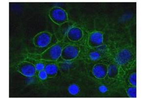 Immunofluorescence of cultured rat neurons and glia showing axonal and dendritic staining of alpha II spectrin (green) revealing the submembranous cytoskeleton and DNA (blue). (SPTAN1 antibody)