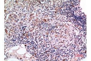 Immunohistochemistry (IHC) analysis of paraffin-embedded Human Lung, antibody was diluted at 1:100. (SCCA1/2 (Internal Region) antibody)