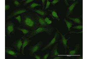 Immunofluorescence of purified MaxPab antibody to CYTH2 on HeLa cell. (Cytohesin 2 antibody  (AA 1-400))