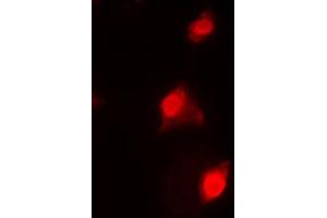 Immunofluorescent analysis of RAD51C staining in HeLa cells. (RAD51C antibody  (Center))